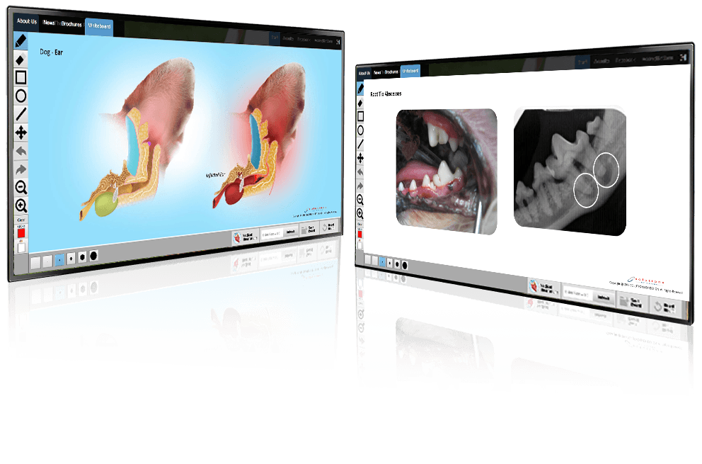 Whiteboard Screens